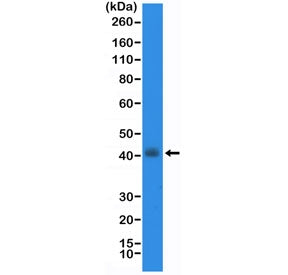 Thyroid transcription factor 1 Antibody / TTF-1 / NKX2.1