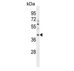 MYBPHL Antibody
