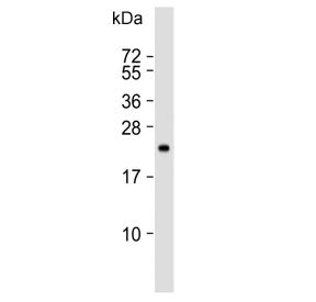 TIMP2 Antibody