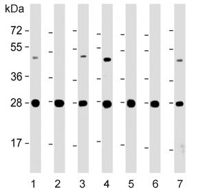 ERAB Antibody / HSD17B10