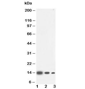 Western blot testing of IL4 antibody and Lane 1: recombinant human protein 10ng; 2: 5ng; 3: 2.5ng. E