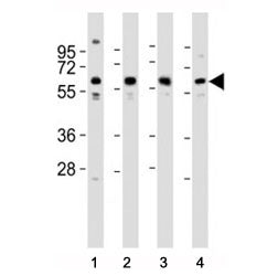 Western blot testing of Pyruvate Kinase antibody at 1:2000 dilution. Lane 1: MCF-7 lysate; 2: HeLa; 