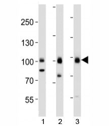 Western blot analysis of lysate from 1) HepG2, 2) MCF-7 cell line and 3) human brain tissue using TL