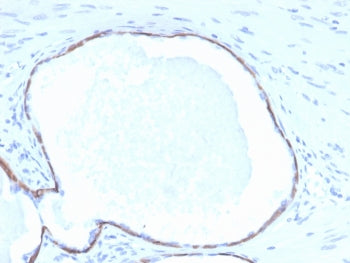 IHC staining of FFPE human prostate tissue with Cytokeratin 14 antibody (clone KRT14/4132). HIER: bo
