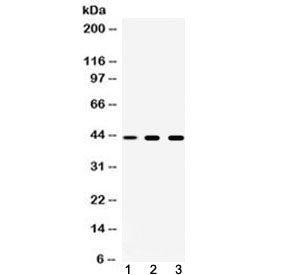 Western blot testing of 1) rat spleen, 2) mouse liver and 3) human A549 cell lysate with TAT antibod