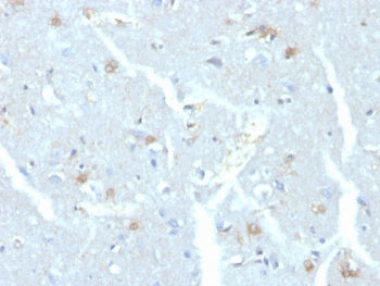 IHC staining of FFPE human brain with UBE2C antibody. HIER: boil tissue sections in pH 9 10mM Tris w