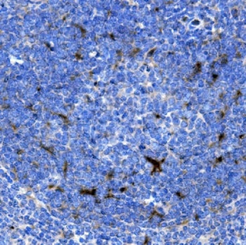 IHC staining of FFPE mouse spleen with SDF1 antibody. HIER: boil tissue sections in pH8 EDTA for 20 