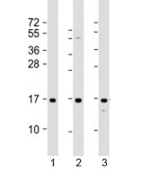 RPLP1 Antibody / 60S acidic ribosomal protein P1