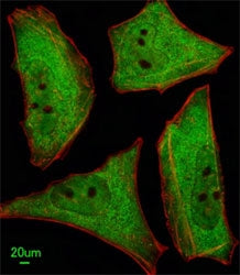 Ubiquilin1 Antibody