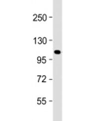 GLI1 Antibody / Glioma associated oncogene 1