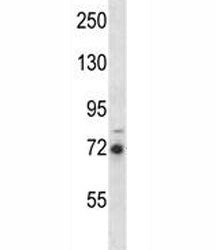 RIPK1 Antibody