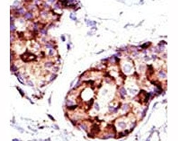 TSG101 Antibody