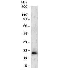Western blot testing of Jurkat lysate with TBPL1 antibody at 2ug/ml. Predicted molecular weight: ~20