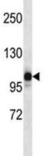 NLRP12 antibody western blot analysis in human placenta tissue lysate. Predicted molecular weight: ~