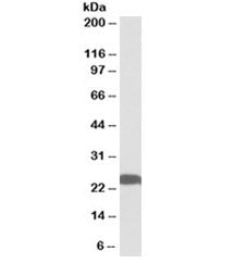 Western blot testing of human hippocampus lysate with PGP9.5 antibody at 0.01ug/ml. Predicted molecu