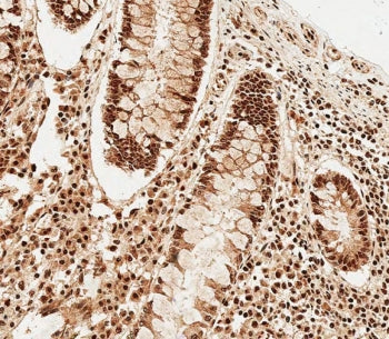 SNRPD3 Antibody / Sm-D3