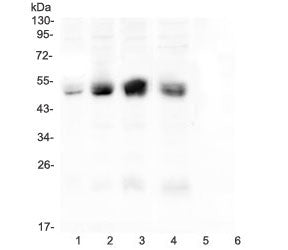 CAR Antibody Coxsackie Adenovirus Receptor