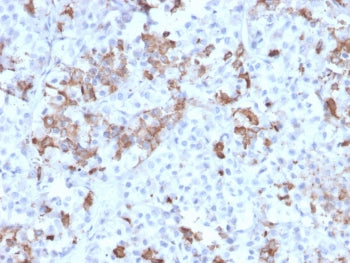IHC testing of FFPE human pituitary tissue with Prolactin antibody (clone PRL/2642). Required HIER: 