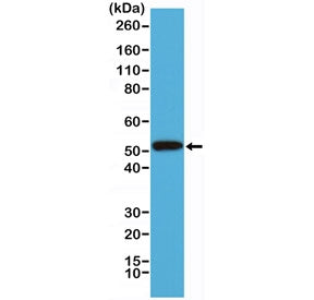 Cytokeratin-14 Antibody / CK14 / KRT14