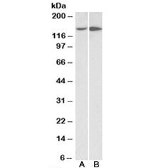 Western blot testing of HeLa [A] and HepG2 [B] lysates with Integrin alpha 1 antibody at 0.5ug/ml. P
