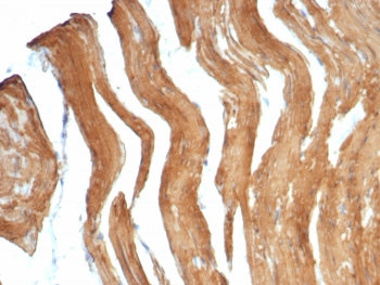 IHC staining of FFPE human smooth muscle tissue with SMMHC antibody (clone MYH11/7610R). HIER: boil 