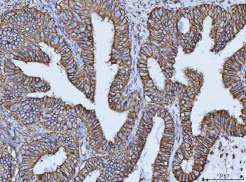CD147 / Emmprin / Basigin Antibody