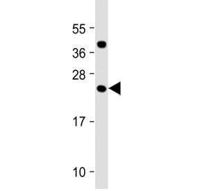 FAM3A Antibody (C-Terminal Region)