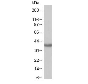 Western blot testing of human kidney with SIRT4 antibody at 1ug/ml. Predicted molecular weight: ~35 