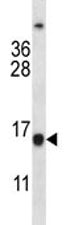 Bcl-2 Antibody