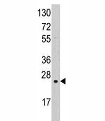 Superoxide Dismutase 2 Antibody (SOD2)