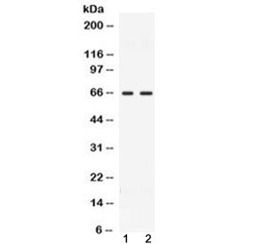 Western blot testing of 1) rat testis and 2) human MCF7 lysate with CCDC6 antibody at 0.5ug/ml. Pred