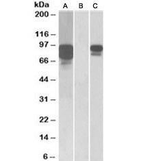PCSK9 Antibody