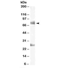 Western blot testing of human testis lysate with CDYL antibody at 1ug/ml. The expected ~75kDa band a