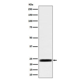 Western blot testing of human HEK293 cell lysate with ARFRP1 antibody. Predicted molecular weight ~23 kDa.