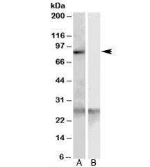 Western blot testing of human heart lysate with SCARF1 antibody at 0.3ug/ml with [B] and without [A]