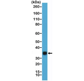 HCGb Antibody / Human Chorionic Gonadotropin beta