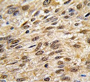 SHP-1 Antibody / PTPN6