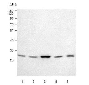 GCLM Antibody / Glutamate-Cysteine Ligase Regulatory Subunit