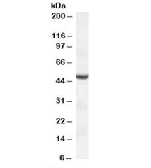 Western blot testing of HEK293 lysate with TMPRSS4 antibody at 1ug/ml. Predicted molecular weight: ~