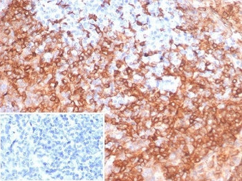IHC staining of FFPE human tonsil tissue with HLA-DR antibody (clone HLA-DRB/7058R). Inset: PBS used
