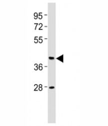Western blot testing of CB2 antibody at 1:2000 dilution + human brain lysate. Predicted molecular we