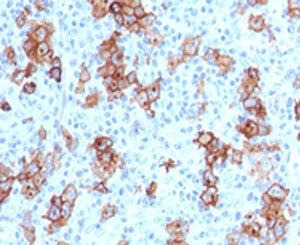 CD30 Antibody