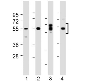Western blot testing of human 1) kidney, 2) lung, 3) placenta and 4) HeLa lysate with SGK1 antibody 