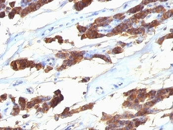 TG Antibody / Thyroglobulin