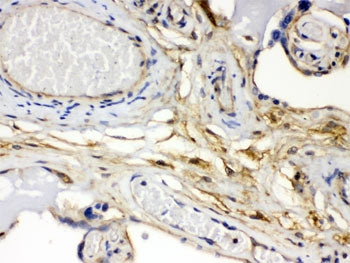 IHC testing of FFPE human placenta with FGF-1 antibody. HIER: Boil the paraffin sections in pH 6, 10