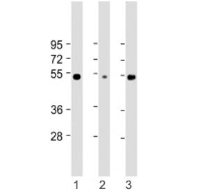 Western blot testing of RBCK1 antibody at 1:2000: Lane 1) human Jurkat, 2) HEK293 and 3) A375 cell l