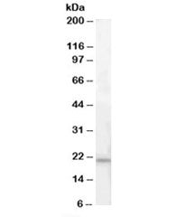 ARMET Antibody