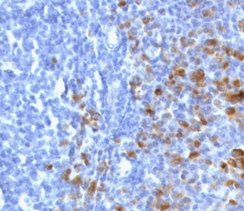 IgG Heavy Chain Antibody