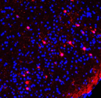 Calretinin Antibody