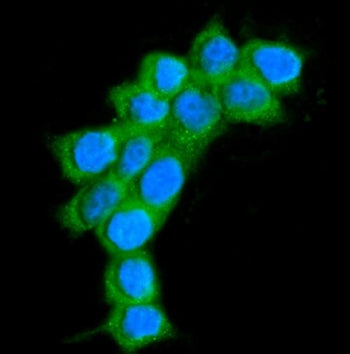AARS1 Antibody / AlaRS
